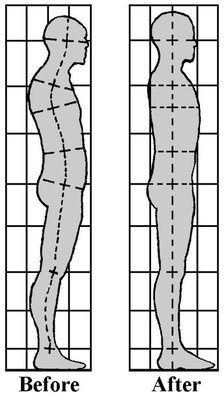 Før og etter diagram av kroppsholdning 